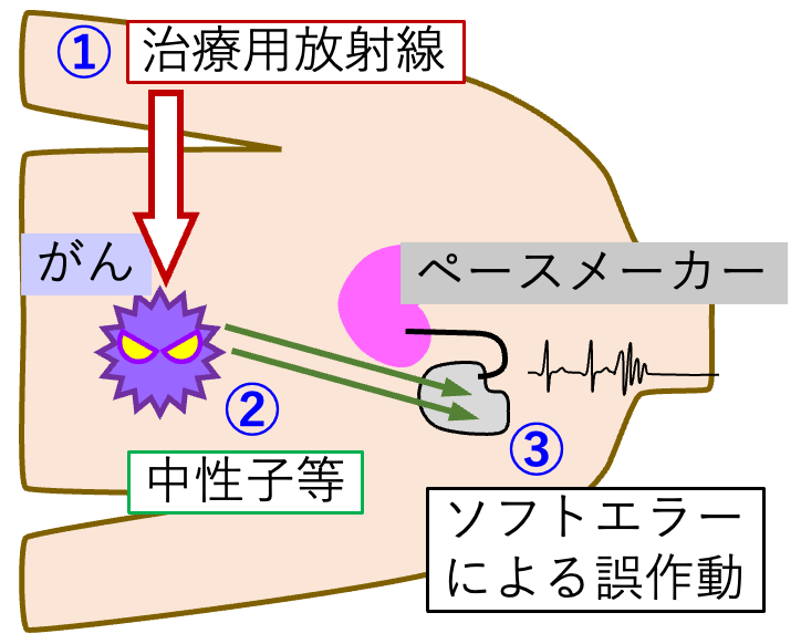 中性子によるソフトエラーの模式図
